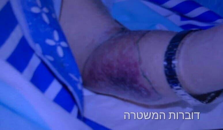 התעללות בקשיש באור יהודה