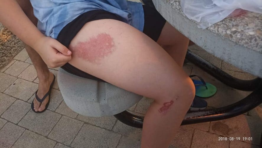 ילד מגבעת שמואל שאושפז במחלקה פסיכיאטרית